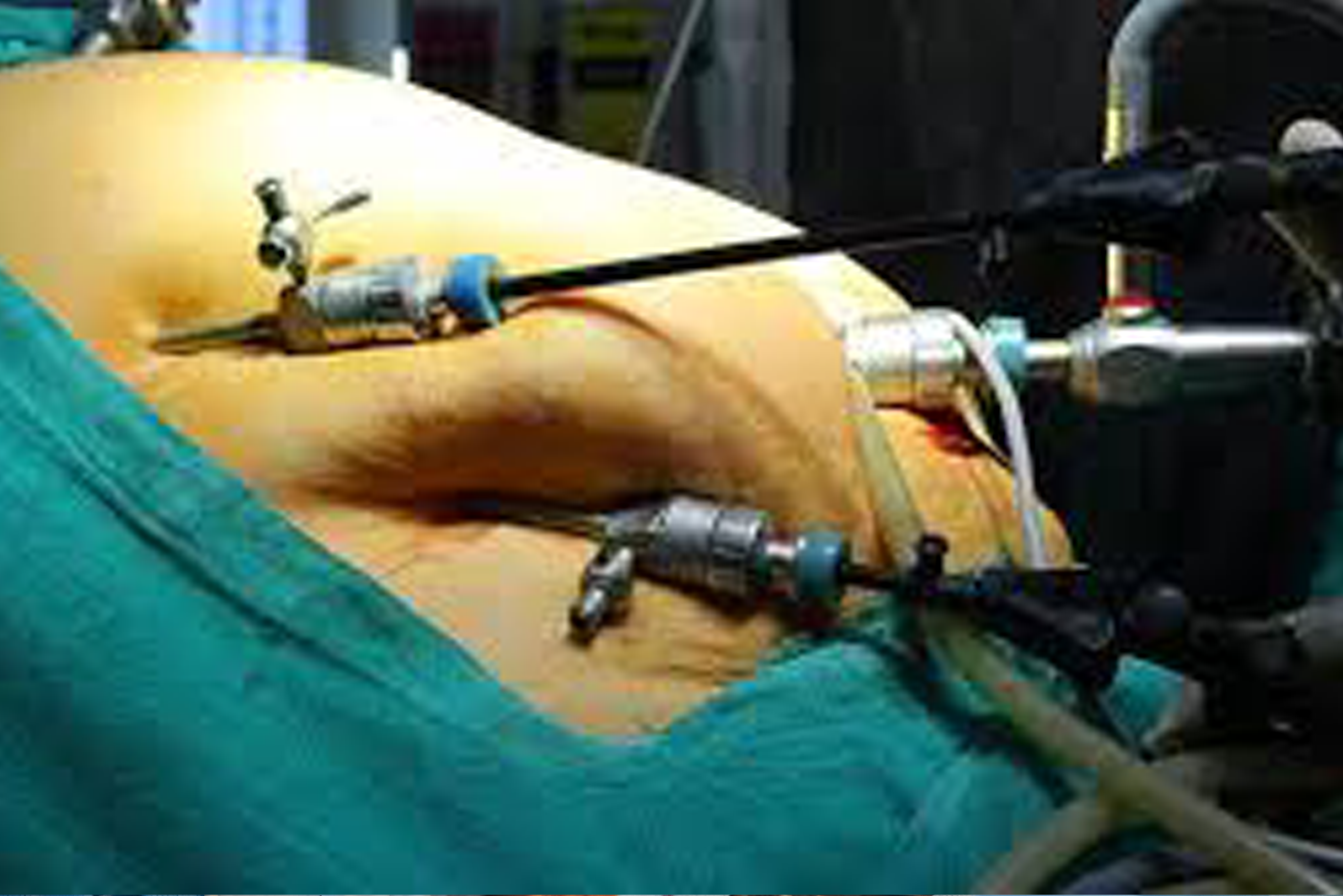Surgeries
